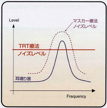 ラビット補聴器　マスカー療法